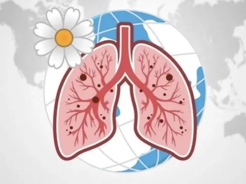 Чурттакчы чонга туберкулез аарыындан канчаар камгаланып болурунуң дугайында удуртулга <p> <p>Туберкулез – кара сагыштыг, чажыт эртер, өске аарыг-биле дөмейлежип, чажыртынып болур аарыг